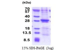 SDS-PAGE (SDS) image for Suppressor of IKBKE 1 (SIKE1) (AA 1-207) protein (His tag) (ABIN6387406) (SIKE1 Protein (AA 1-207) (His tag))