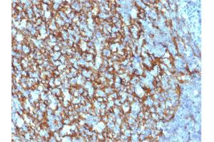 Immunohistochemistry (IHC) image for anti-Complement Component (3d/Epstein Barr Virus) Receptor 2 (CR2) (AA 44-196) antibody (ABIN6939182)