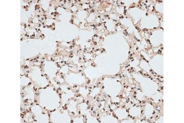 ZNF141 antibody