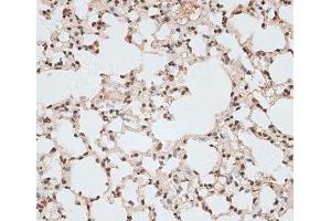 Immunohistochemistry of paraffin-embedded Mouse lung using ZNF141 Polyclonal Antibody at dilution of 1:100 (40x lens).