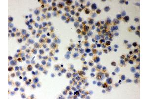 Anti- MIF Picoband antibody, ICC ICC: JURKAT Cell (MIF antibody  (AA 2-115))