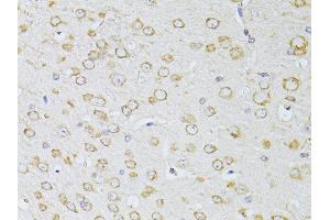 Immunohistochemistry of paraffin-embedded mouse brain using NTS antibody (ABIN5998396) at dilution of 1/100 (40x lens). (Neurotensin antibody)