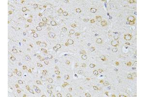 Immunohistochemistry of paraffin-embedded mouse brain using NTS antibody (ABIN5998396) at dilution of 1/100 (40x lens). (Neurotensin antibody)