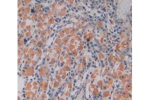 Immunohistochemistry (Paraffin-embedded Sections) (IHC (p)) image for anti-Solute Carrier Family 9 (Sodium/hydrogen Exchanger), Member 3 Regulator 2 (SLC9A3R2) (AA 56-337) antibody (ABIN2904528)