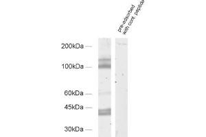 dilution: 1 : 1000, sample: synaptic membrane fraction of rat brain (LP1)