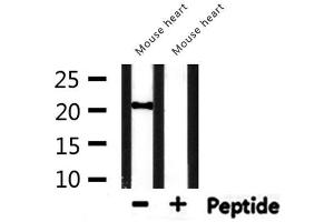 Western blot analysis of extracts from mouse heart, using CBX5 Antibody. (CBX5 antibody  (Internal Region))