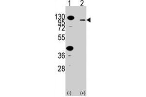 Western blot analysis of FGFR2 polyclonal antibody  in 293 cell line lysates transiently transfected with the FGFR2 gene (2 ug/lane). (FGFR2 antibody  (AA 22-51))