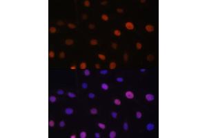 Immunofluorescence analysis of U-2 OS cells using UHRF2 antibody (ABIN6133264, ABIN6149911, ABIN6149913 and ABIN6217665) at dilution of 1:100. (UHRF2 antibody  (AA 441-622))