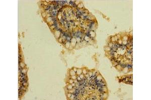 Immunohistochemistry of paraffin-embedded human small intestine tissue using ABIN7147859 at dilution of 1:100 (CLTB antibody  (AA 1-211))