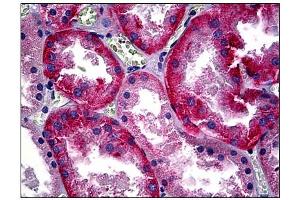 Immunohistochemistry (IHC) image for anti-Basigin (Ok Blood Group) (BSG) antibody (ABIN781851) (CD147 antibody)