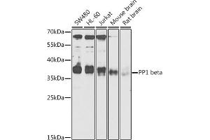 Western blot analysis of extracts of various cell lines, using PP1 beta antibody (ABIN6128486, ABIN6146055, ABIN6146057 and ABIN6217560) at 1:1000 dilution.