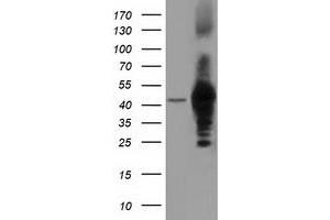 HEK293T cells were transfected with the pCMV6-ENTRY control (Left lane) or pCMV6-ENTRY DNAJA2 (Right lane) cDNA for 48 hrs and lysed. (DNAJA2 antibody)