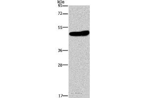 Western blot analysis of Mouse brain tissue, using KCNG2 Polyclonal Antibody at dilution of 1:650 (Kcng2 antibody)
