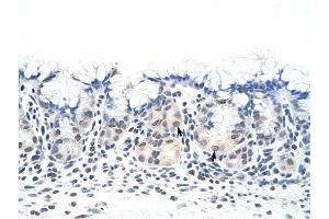 DAZ4 antibody was used for immunohistochemistry at a concentration of 4-8 ug/ml to stain Epithelial cells of fundic gland (arrows) in Human Stomach. (DAZ4 antibody  (N-Term))