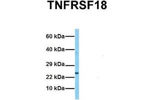 Host:  Rabbit  Target Name:  TNFRSF18  Sample Tissue:  Human HCT116  Antibody Dilution:  1. (TNFRSF18 antibody  (C-Term))