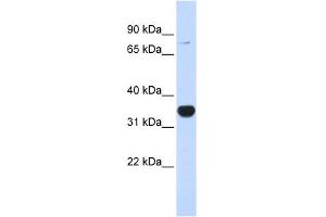 RHOT1 antibody used at 1 ug/ml to detect target protein. (RHOT1 antibody  (N-Term))