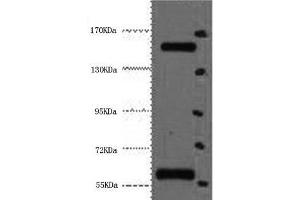 Western Blot analysis of Hela cells using CD45 Monoclonal Antibody at dilution of 1:2000. (CD45 antibody)