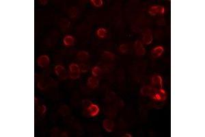 Immunofluorescent analysis of S100-A12 staining in SW620 cells. (S100A12 antibody)