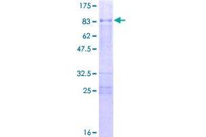 Image no. 1 for Kruppel-Like Factor 10 (KLF10) (AA 1-480) protein (GST tag) (ABIN1308731) (KLF10/TIEG1 Protein (AA 1-480) (GST tag))