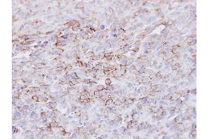 IHC-P Image Immunohistochemical analysis of paraffin-embedded MDAMB231 xenograft, using CD73, antibody at 1:100 dilution. (CD73 antibody)