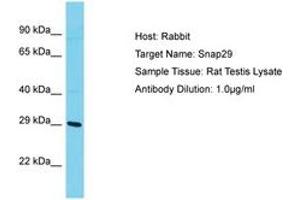 Image no. 1 for anti-Synaptosomal-Associated Protein, 29kDa (SNAP29) (AA 141-190) antibody (ABIN6750423)