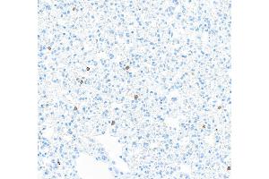 Immunohistochemistry (IHC) image for anti-CD8a Molecule (CD8A) (AA 28-194) antibody (ABIN7453877) (Recombinant CD8 alpha antibody  (AA 28-194))