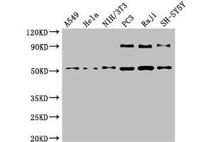 Western Blot Positive WB detected in: A549 whole cell lysate, Hela whole cell lysate, NIH/3T3 whole cell lysate, PC-3 whole cell lysate, Raji whole cell lysate, SH-SY5Y whole cell lysate All lanes: BECN1 antibody at 4 μg/mL Secondary Goat polyclonal to rabbit IgG at 1/50000 dilution Predicted band size: 52 kDa Observed band size: 52 kDa (Beclin 1 antibody  (AA 1-100))