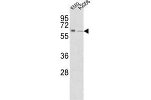 Western blot analysis of FPGS Antibody (Center) in K562, A2058 cell line lysates (35 µg/lane). (FPGS antibody  (Middle Region))