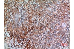 Immunohistochemistry (IHC) analysis of paraffin-embedded Human Brain, antibody was diluted at 1:100. (CGREF1 antibody  (N-Term))