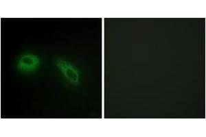Immunofluorescence analysis of HeLa cells, using GLU2B Antibody.