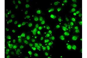 Immunofluorescence analysis of MCF7 cells using QKI antibody (ABIN6128587, ABIN6146533, ABIN6146534 and ABIN6222826). (QKI antibody  (AA 1-341))