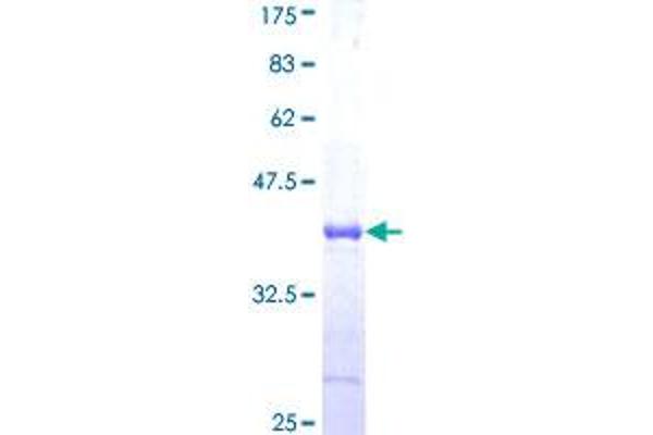 HERC5 Protein (AA 915-1024) (GST tag)