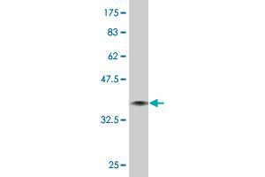 Western Blot detection against Immunogen (38. (SPEG antibody  (AA 1-113))