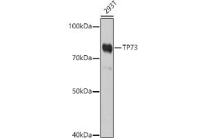 Western blot analysis of extracts of 293T cells, using TP73 antibody (ABIN6133470, ABIN6149430, ABIN6149431 and ABIN6213831) at 1:1000 dilution. (Tumor Protein p73 antibody  (AA 1-100))