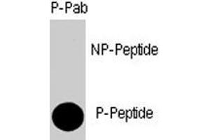 Dot blot analysis of SMAD4 (phospho T277) polyclonal antibody  on nitrocellulose membrane.