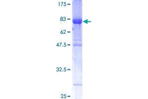IRF6 Protein (AA 1-467) (GST tag)