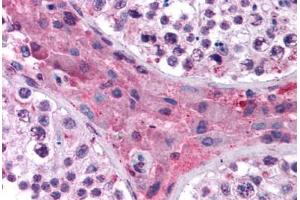 Human Testis (formalin-fixed, paraffin-embedded) stained with NR1H4 antibody ABIN214795 at 5 ug/ml followed by biotinylated goat anti-rabbit IgG secondary antibody ABIN481713, alkaline phosphatase-streptavidin and chromogen. (NR1H4 antibody  (AA 194-243))