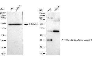 Western blotting analysis using Core-binding factor subunit beta antibody (ABIN7798155). (Recombinant CBFB antibody)