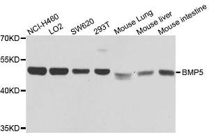 BMP5 antibody  (AA 317-454)