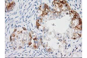 Image no. 9 for anti-BAI1-Associated Protein 2 (BAIAP2) antibody (ABIN1496805) (BAIAP2 antibody)