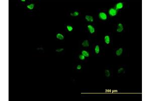 Immunofluorescence (IF) image for anti-Homeobox A11 (HOXA11) (AA 60-166) antibody (ABIN516621)
