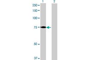 anti-Leucine-Rich Repeats and Calponin Homology (CH) Domain Containing 3 (LRCH3) (AA 1-712) antibody