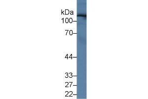 Western Blot; Sample: Human Serum; Primary Ab: 1µg/ml Rabbit Anti-Human UGGT2 Antibody Second Ab: 0. (UGCGL2 antibody  (AA 1221-1408))