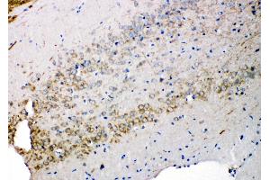 Anti-Syndecan 3 antibody, IHC(P) IHC(P): Rat Brain Tissue (SDC3 antibody  (N-Term))