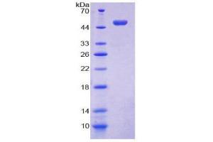 SDS-PAGE (SDS) image for Lectin, Galactoside-Binding, Soluble, 13 (LGALS13) (AA 1-139) protein (His tag,GST tag) (ABIN2123471) (LGALS13 Protein (AA 1-139) (His tag,GST tag))