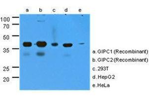 The cell lysates (40 ug) were resolved by SDS-PAGE, transferred to PVDF membrane and probed with GIPC antibody (1:1000). (GIPC1 antibody  (AA 1-315))