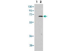 Western blot analysis of PIAS1 (arrow) using PIAS1 polyclonal antibody . (PIAS1 antibody  (C-Term))