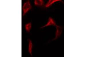 ABIN6269120 staining NIH-3T3 by IF/ICC. (c-MET antibody  (Internal Region))