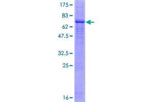 PRKX Protein (AA 1-358) (GST tag)