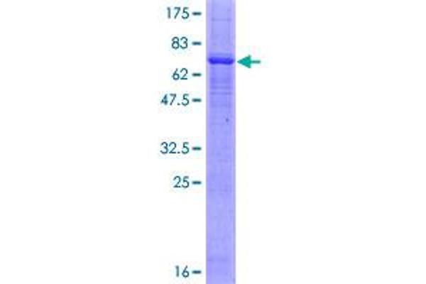 PRKX Protein (AA 1-358) (GST tag)
